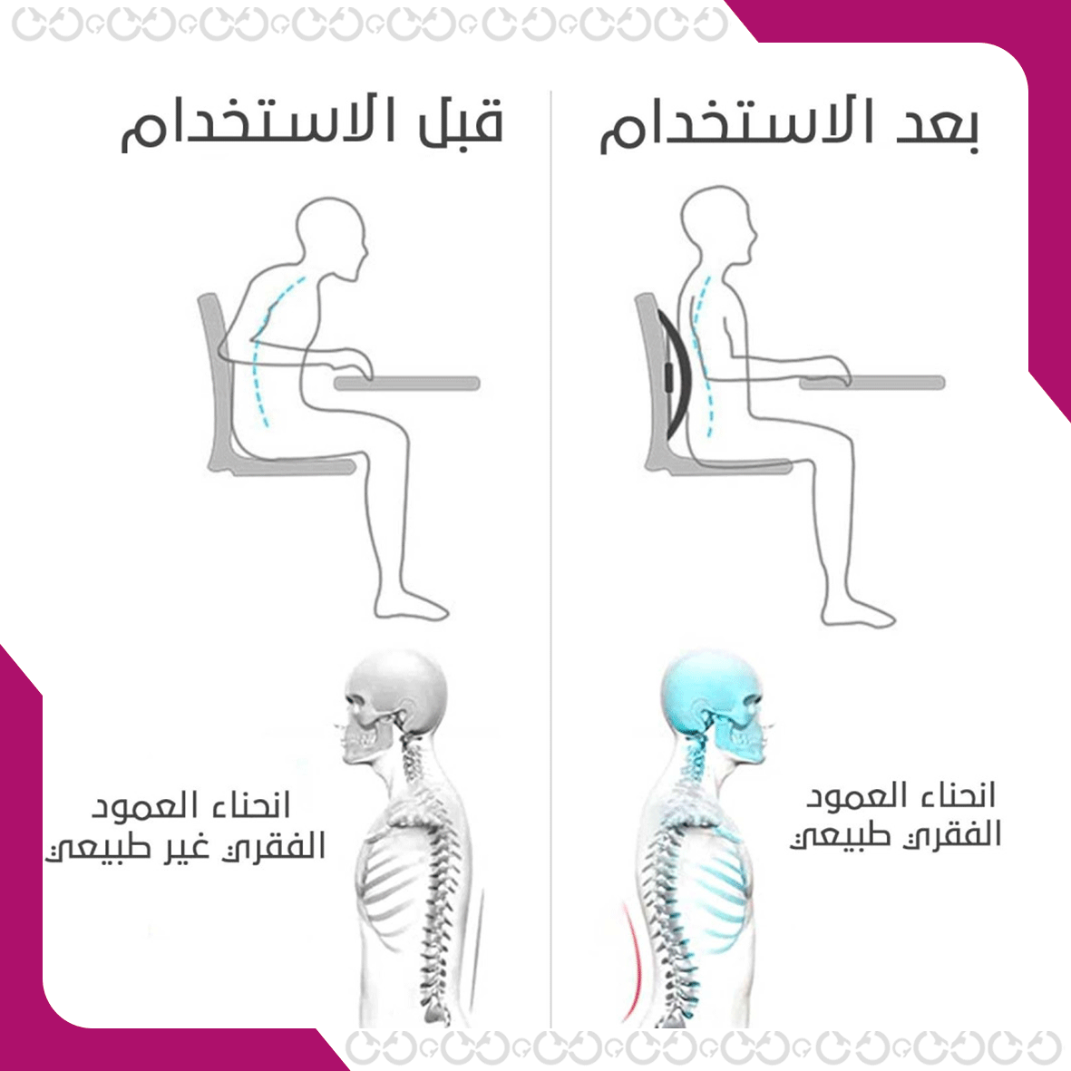 فوائد أداة مساج الظهر - متعددة الخيارات