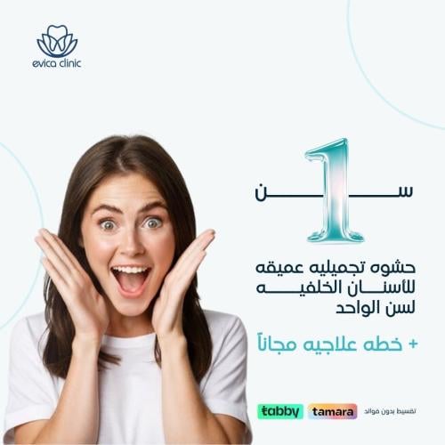 حشوه تجميليه عميقه للأسنان الخلفيه