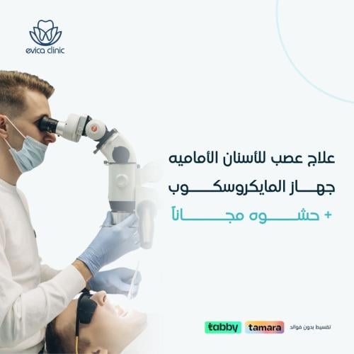 علاج عصب للأسنان الأماميه بجهاز المايكروسكوب + حشو...