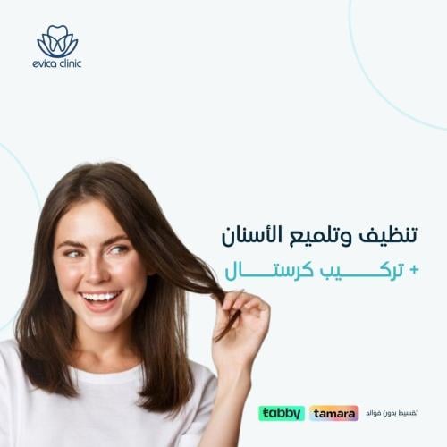 تنظيف وتلميع الأسنان + تركيب كرستال