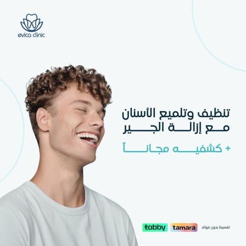 تنظيف وتلميع الأسنان مع إزالة الجير + كشفيه مجاناً