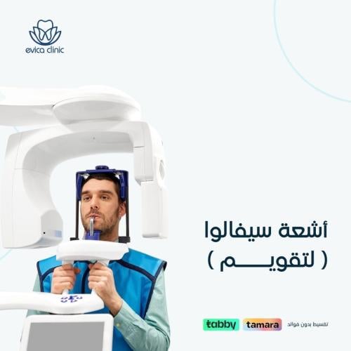 أشعة سيفالوا ( لتقويم الأسنان )