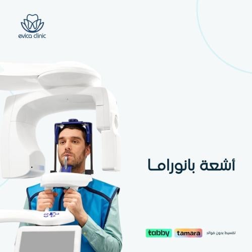أشعة بانوراما للفكين