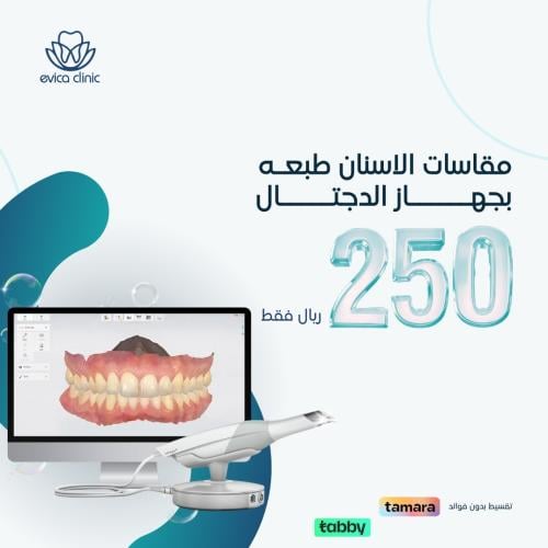مقاسات الأسنان طبعة ديجيتال