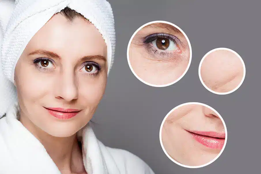 الديرمارولر للوجه | الحل السحري لعلاج الكلف وتصبغات الجلد