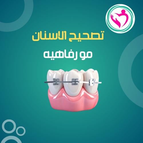 شد التقويم للفك