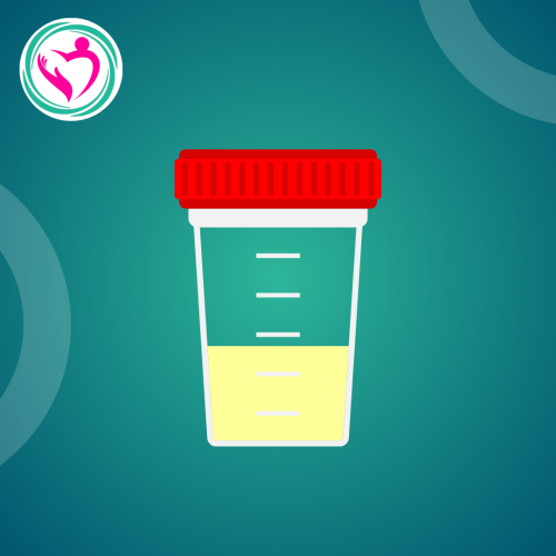 URINE ANALYSIS-تحليل البول