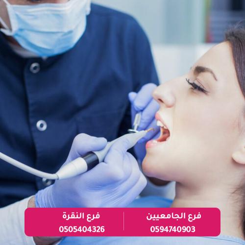 تنظيف الاسنان