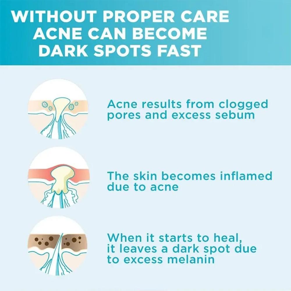 سيروم غارنيه الازرق